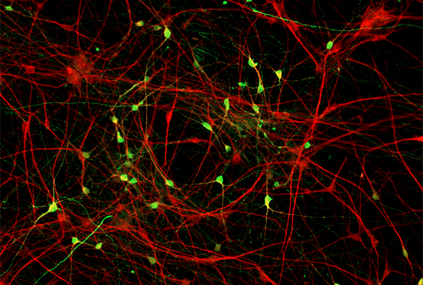 Neurons in red and green