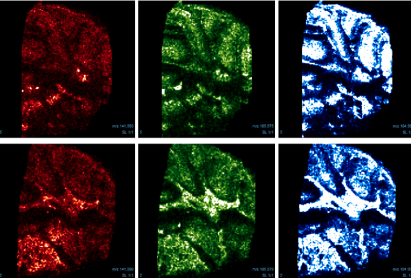 brainstem of rats in red, green and blue highlight higher levels of GABA.