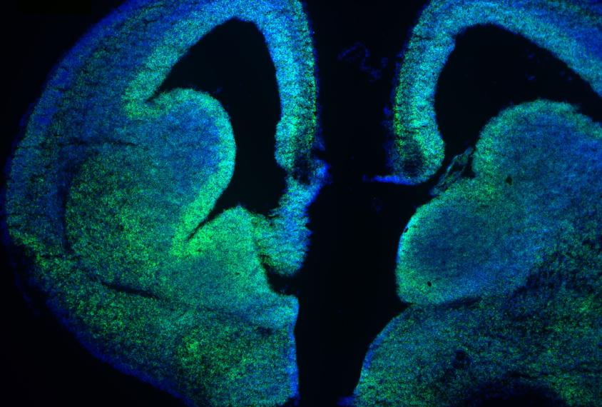 exon in the developing brain with a technique called in situ hybridization, in blue and green colors.