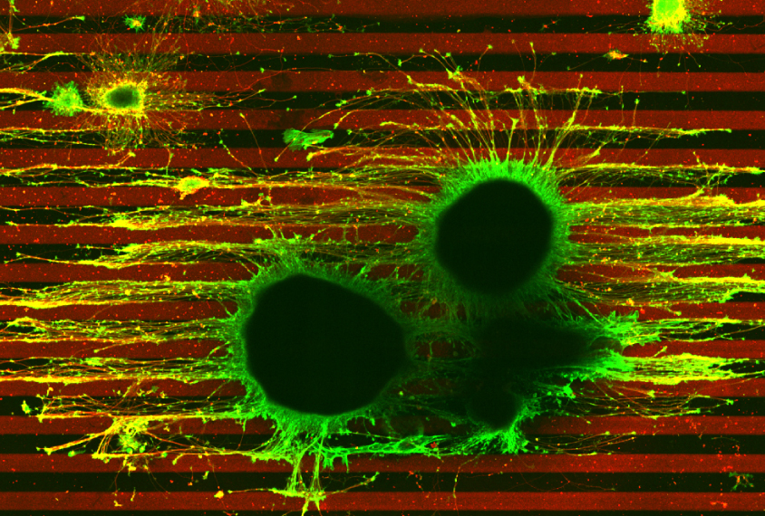 Micrograph of two developing axons, one with one copy of TSC2 gene and the other with two copies.