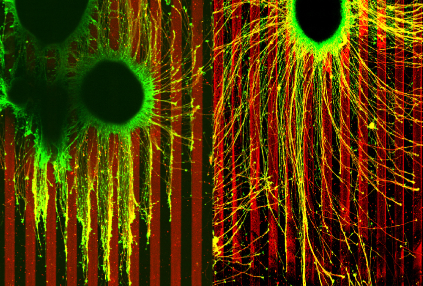 Two axons, one with one copy of TSC2 gene and the other with two.