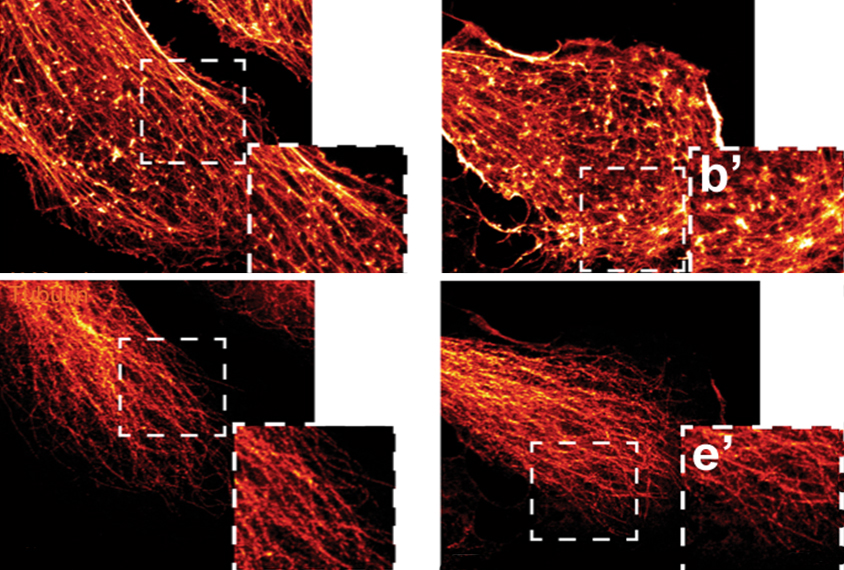 Mouse brain cells seen in red