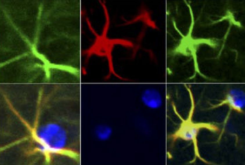 Micrographs of mouse astrocytes with high levels of inflammatory molecules.