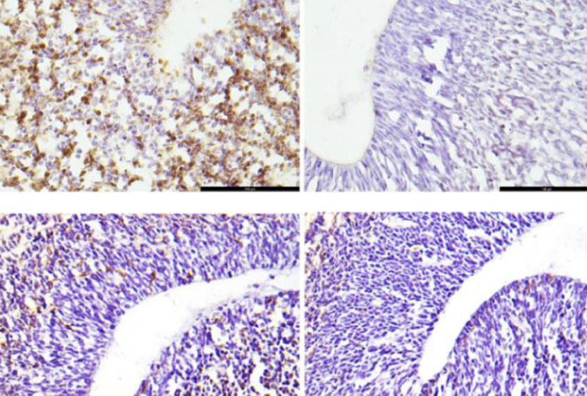 Micrograph showing fewer neurons in fetal mice whose mothers have only one functional copy of PTEN.