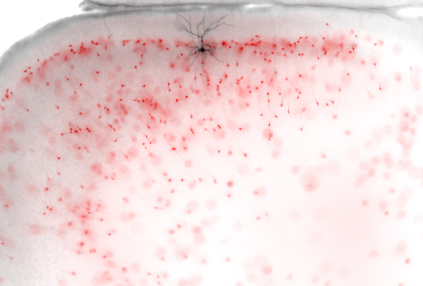 Immature inhibitory cells surround mature neuron.