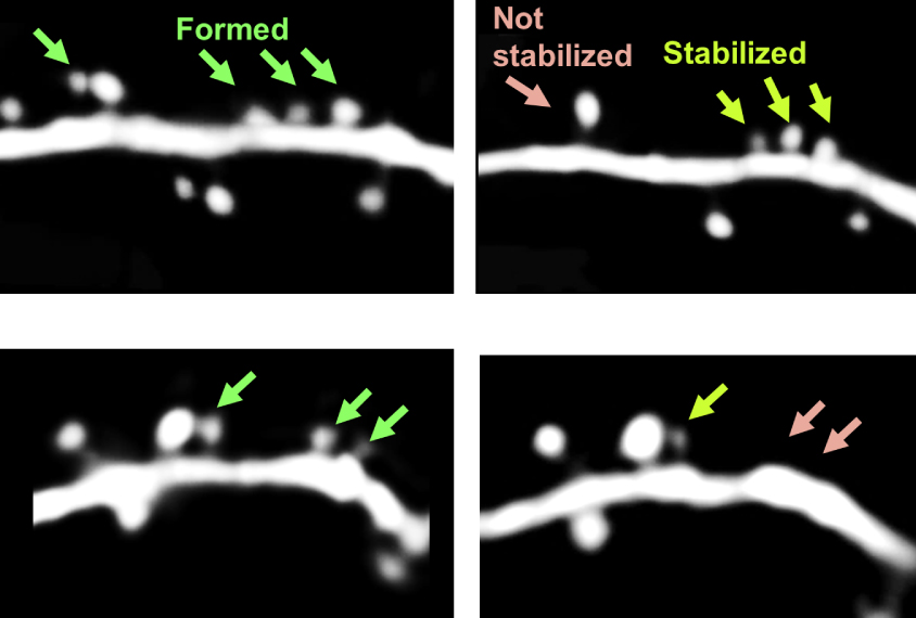 Micrographs comparing motor cortex neurons in mice with and without an extra copy of MECP2 gene.