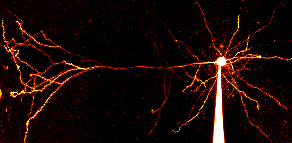 Images shows a pyramidal neuron.