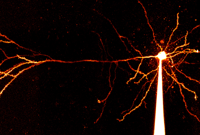 Images shows a pyramidal neuron.