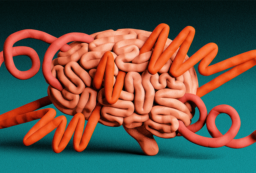 Illustration of brain showing overexcited and underexcited parts of the brain represented by jagged and loose squiggles.