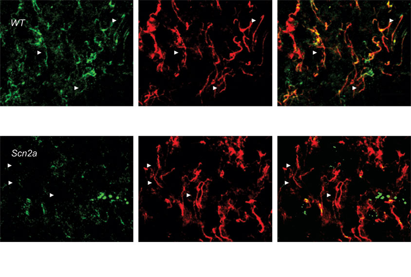 Micrograph showing missing sodium ion channels in cerebral cortex of mice with two mutated copies of SCN2A gene.