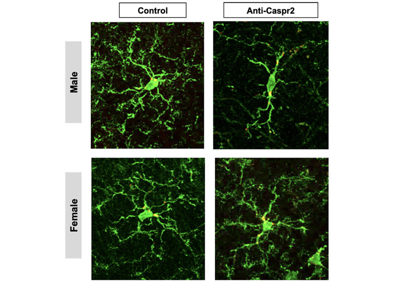 Micrographs of microglia in male and female mice exposed to auto-antibodies in the womb.