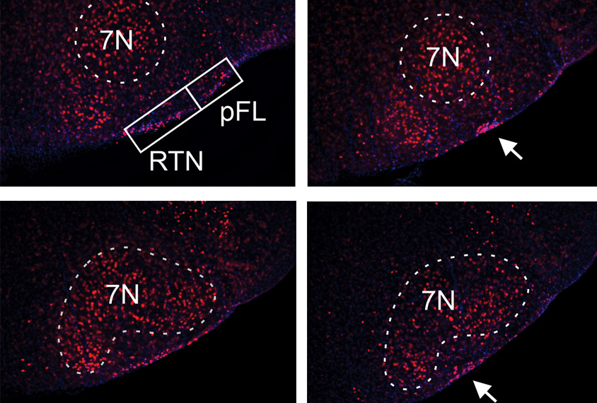 Mouse neurons in red and pink on black.