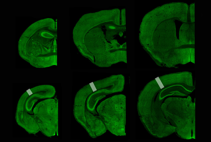 UBE3A expression in mouse brain slices, shown in green.