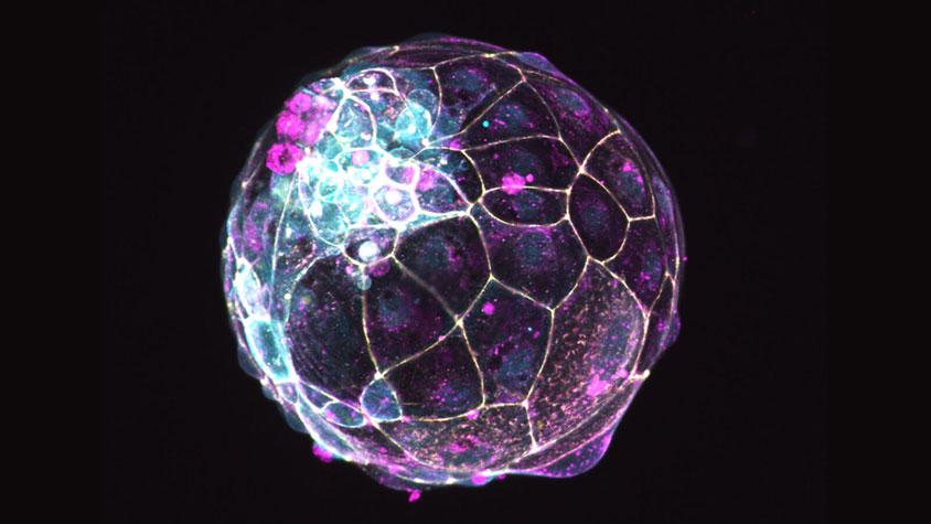 Colorful micrograph of a human embryo.