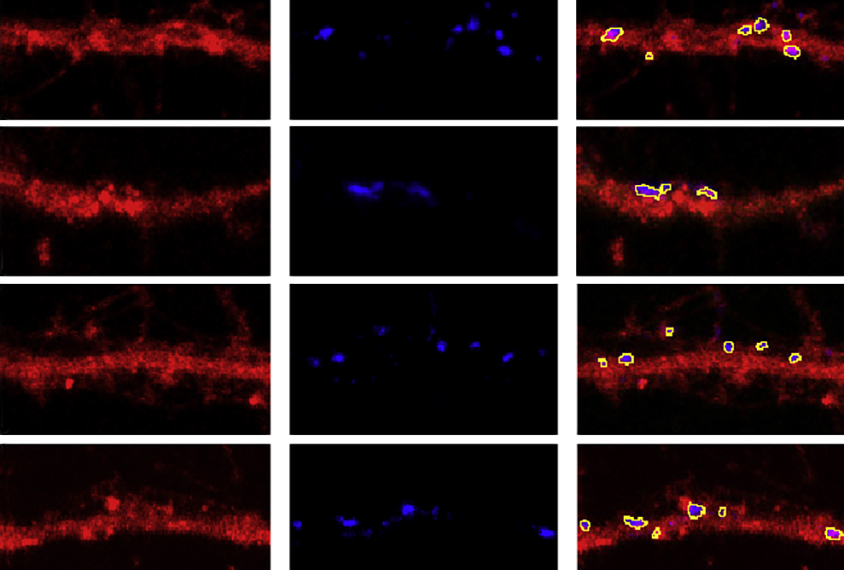 grid of 12 views of mouse neurons.