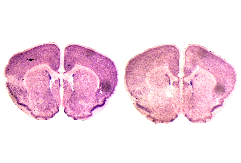 Normal mouse brain (left) vs brain in mouse lacking POGZ gene (right)