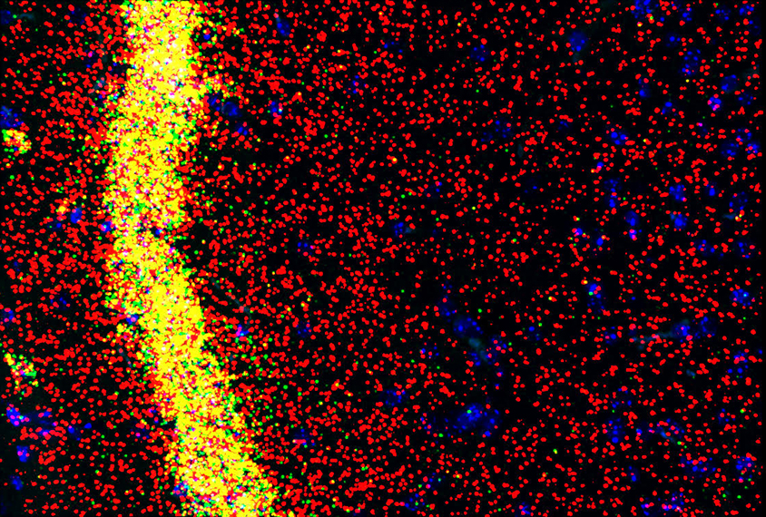 Micrograph showing distinct RNA species found in CA1 hippocampal neuronal cell bodies (yellow) and dendrites (red) undergoing compartmentalized RNA regulation.