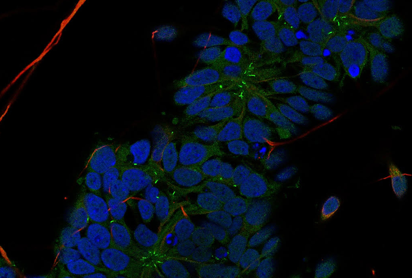 Lab images of cilia.