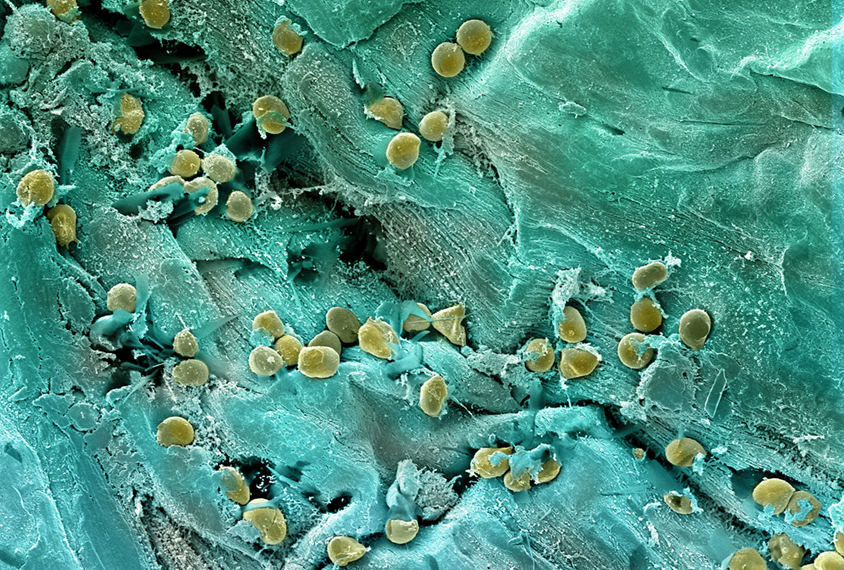 Micrograph of intestinal bacteria.