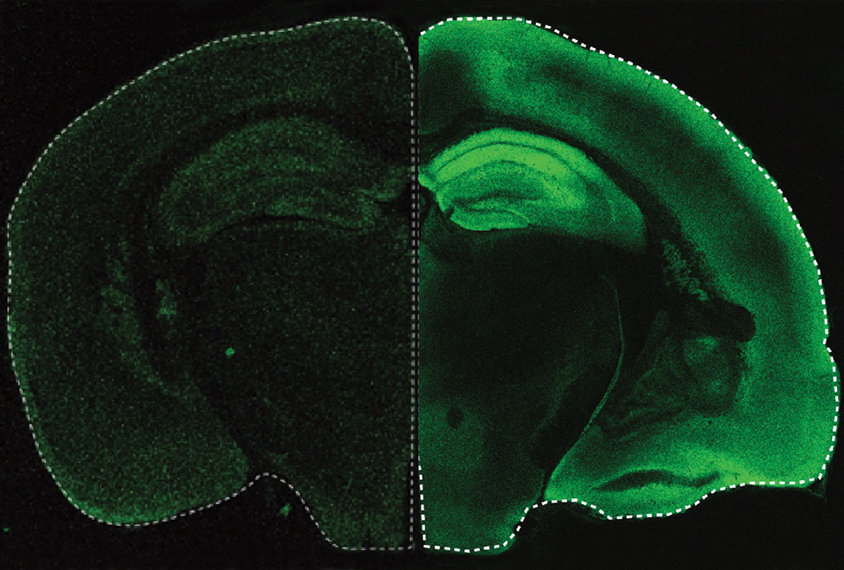 Micrograph showing mouse brain with green highlights indicating areas of shifting strength in neuronal connections.