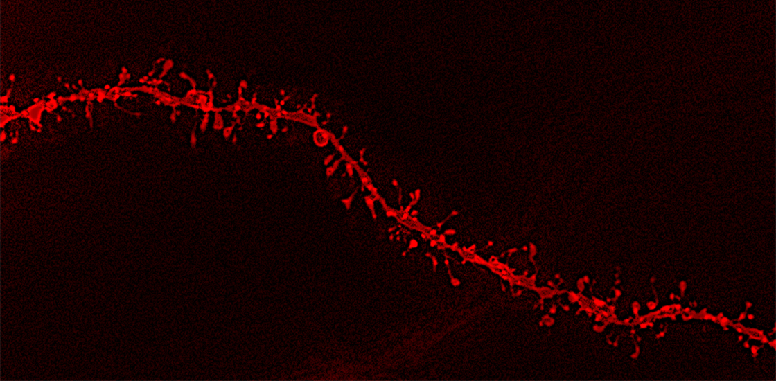 Micrograph of neuron dendrite segments.