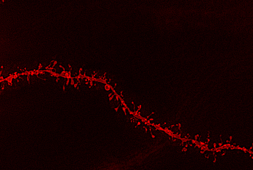 Micrograph of neuron dendrite segments.