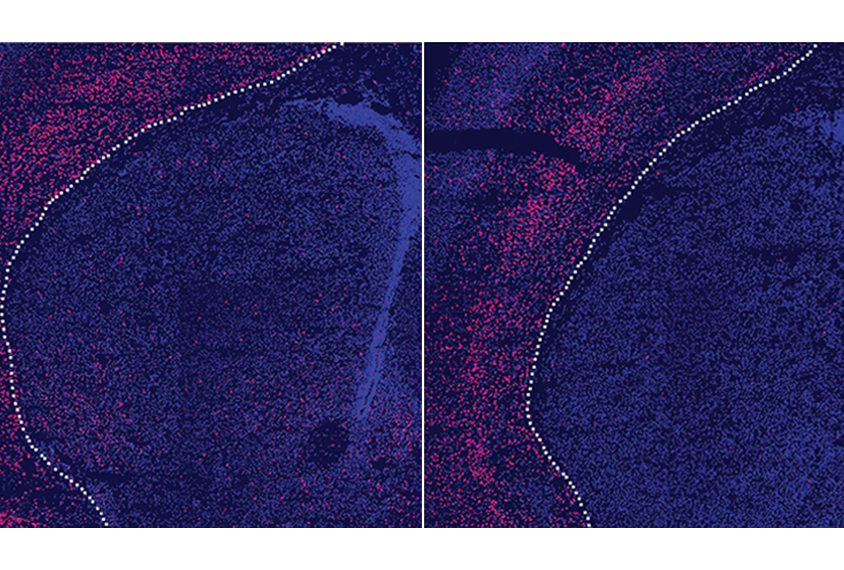 Micrographs comparing mouse striatal neurons missing TSHZ3 and wildtype striatal neurons.
