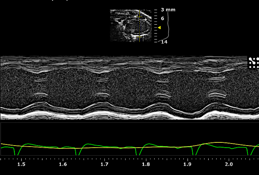 Ultrasound in black and white shows a pattern.