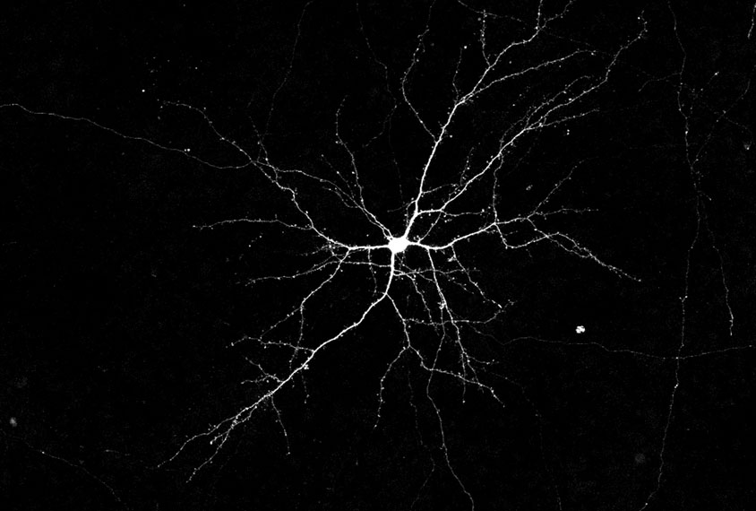 Neuron with dendrites, showing white on solid black.