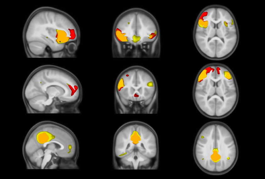 a grid of 9 brain maps showing activity in different areas of the brain