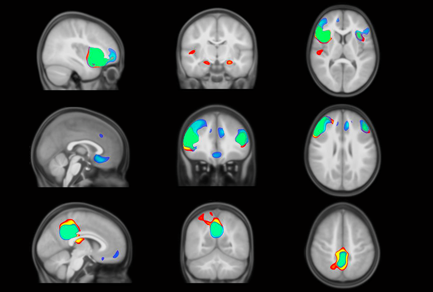 a grid of 9 brain maps showing activity in different areas of the brain