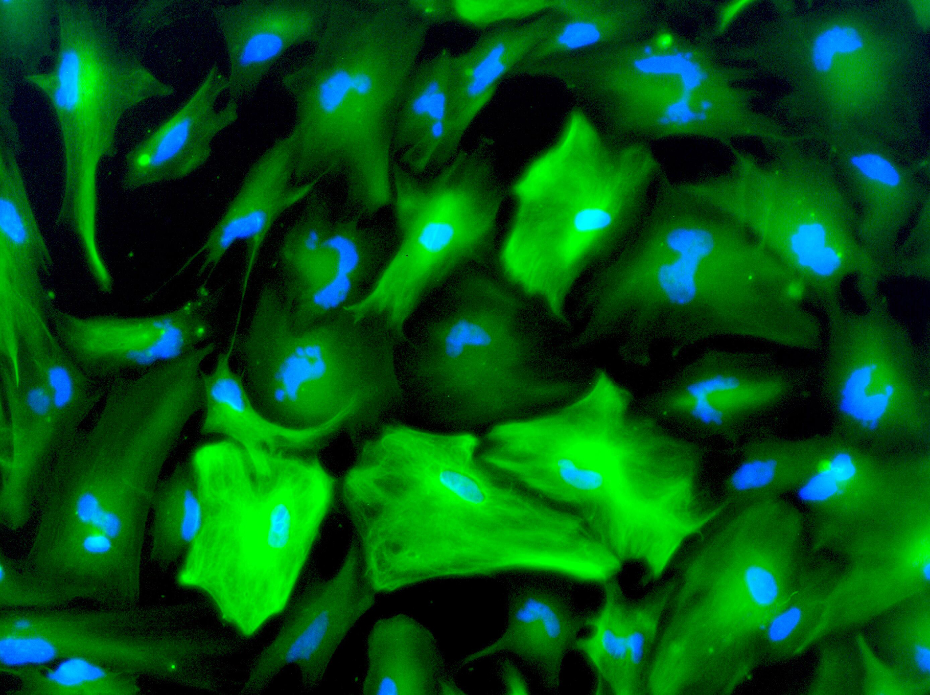 Astrocytes in blue and green, derived from human neural stem cells.