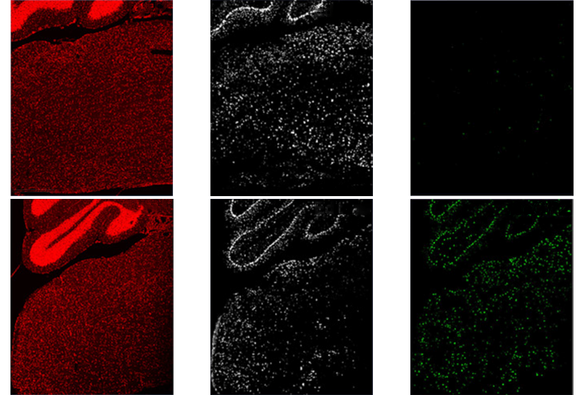 Set of 6 scans shows mice recovering MECP2 protein in their brainstem after being treated with RNA-editing viruses.