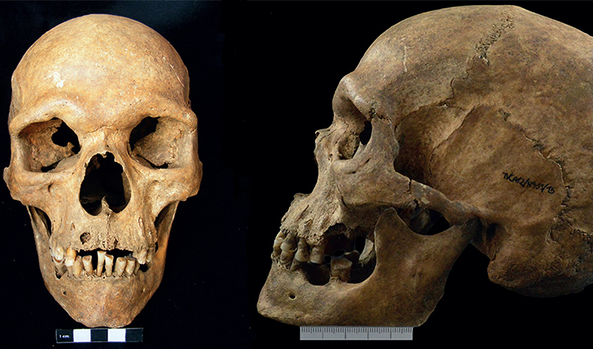 Two images of a skull