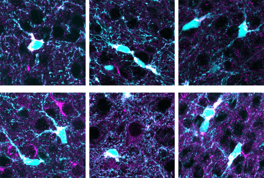 six images of astrocytes