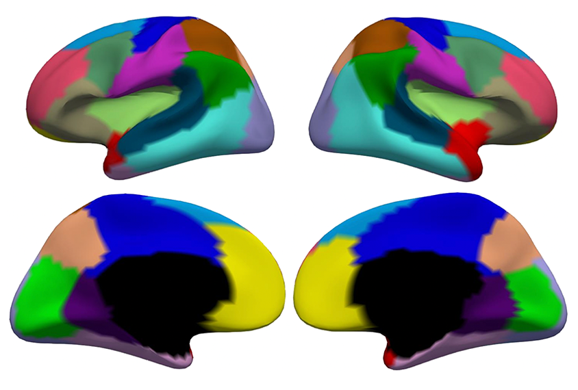 A set of 4 multicolored brain scans showing development of cortical surface area.