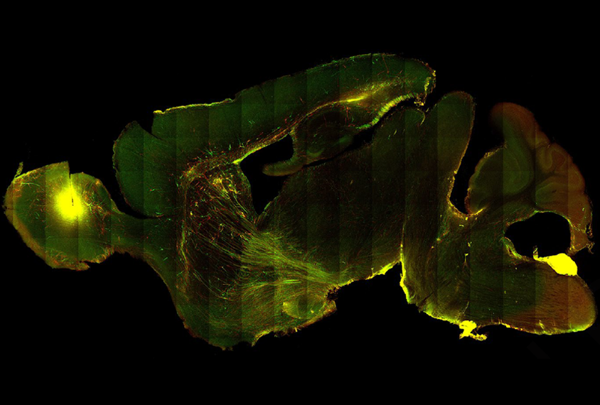 Brain slice of a mouse brain showing cells carrying the fragile X mutation.