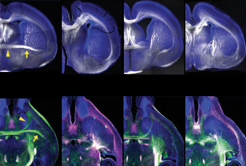 Brain scans demonstrating differences in mice with TBR1 mutations.