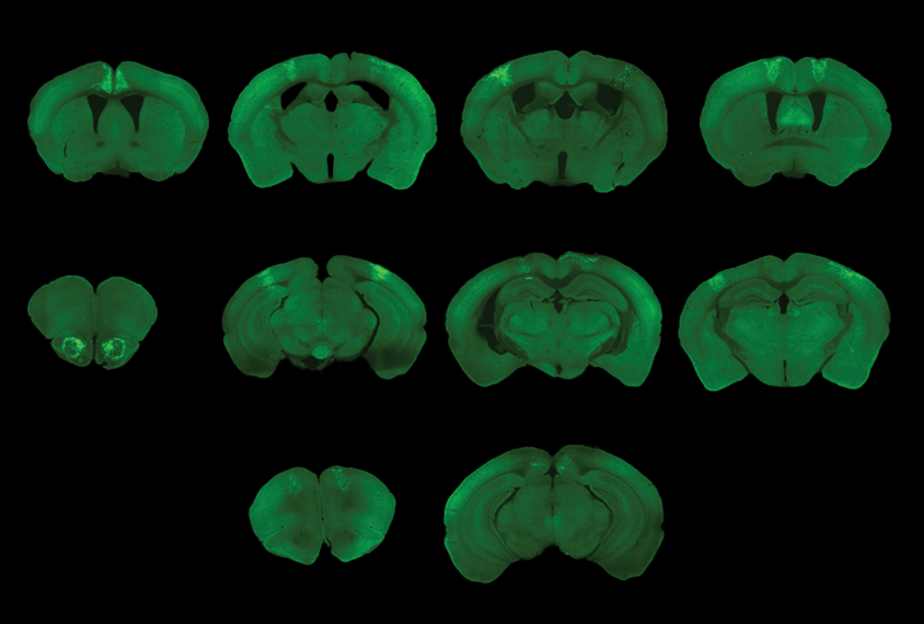 Mouse brain slices showing the effects of SHANK2 and SHANK3 deletions.