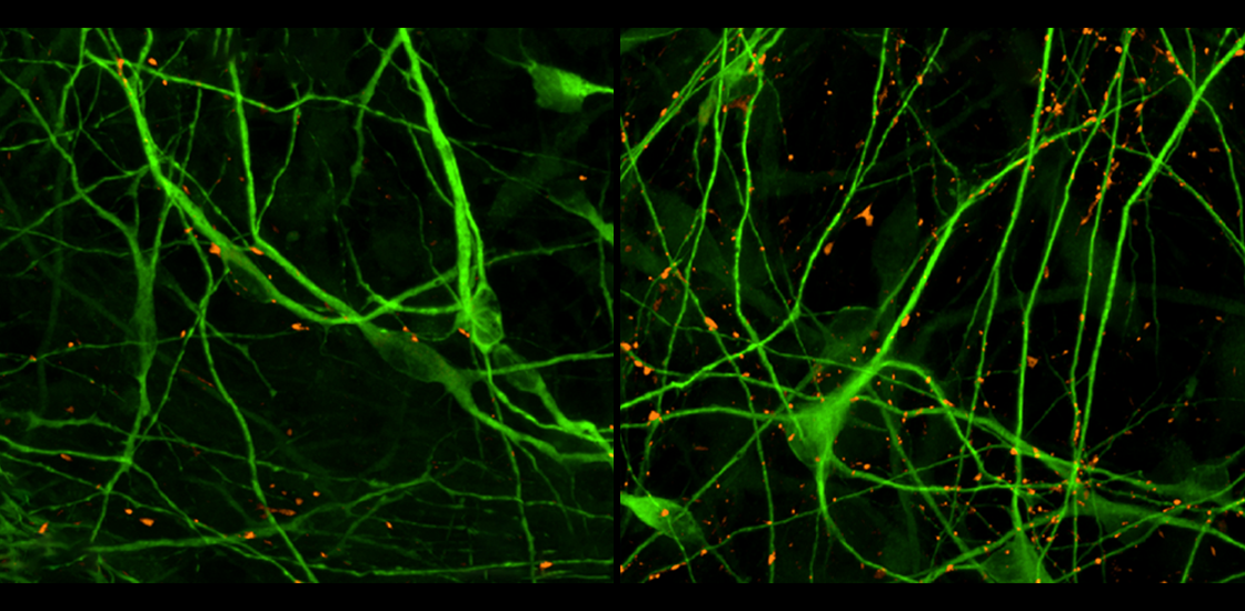 Image of organoids modeling CDKL5 deficiency disorder.