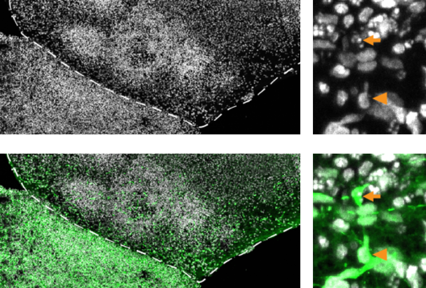 Image displaying impeded interneuron development.