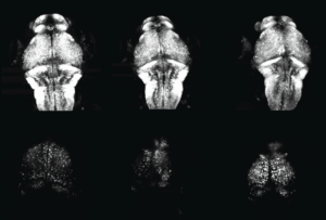 Series of zebrafish brain scans.