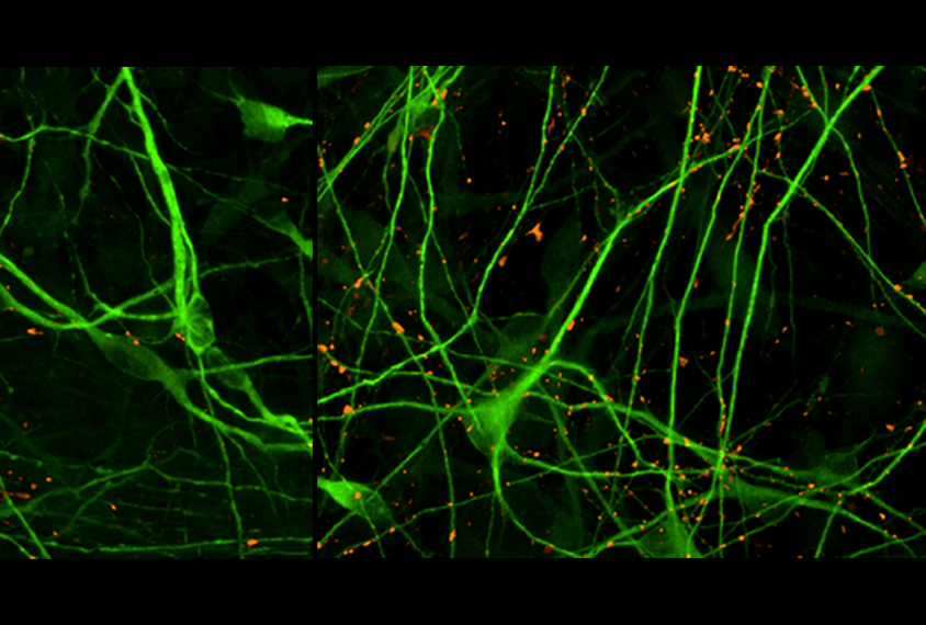 Image of organoids modeling CDKL5 deficiency disorder.