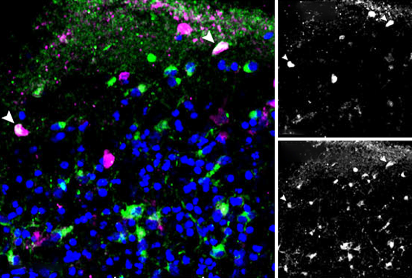 Composite image of inhibitory and excitatory neurons.