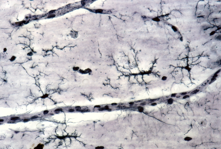 Light micrograph of microglia cells stained with Rio Hortega’s silver carbonate method.