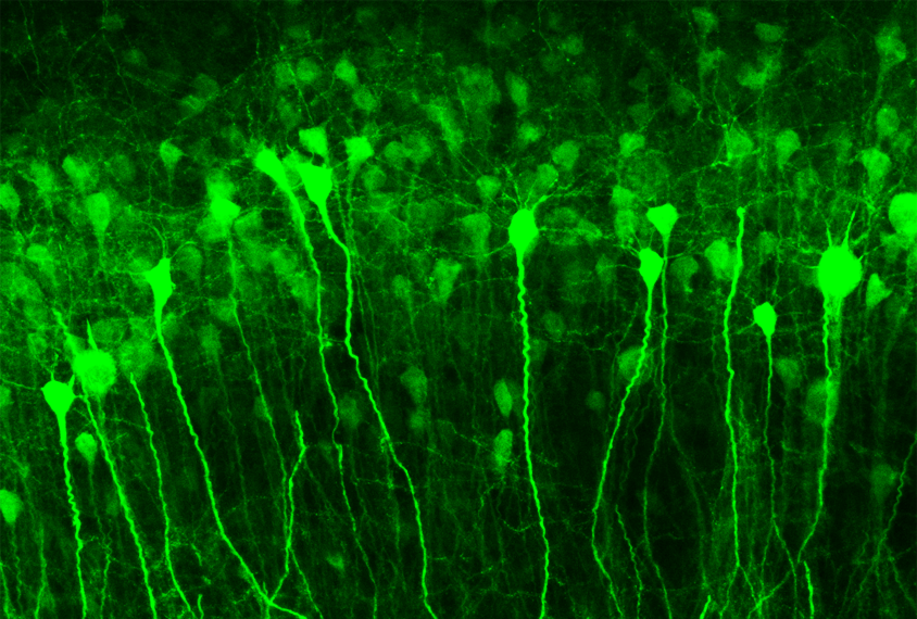 Image of neurons during a seizure.