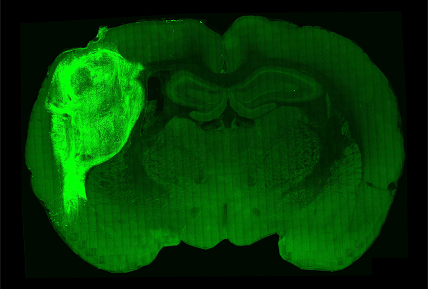 A transplanted human organoid labeled with a fluorescent protein in a section of the rat brain.
