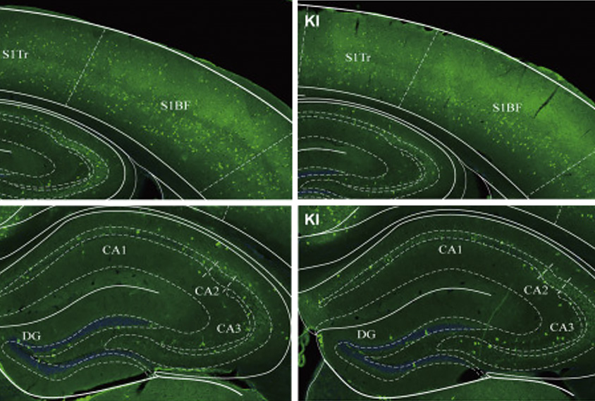 Images of the hippocampus