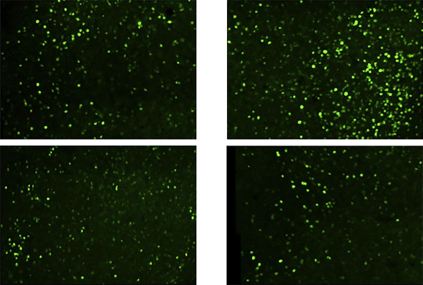 Research image showing neuronal activity in mice exposed to high-frequency sounds.