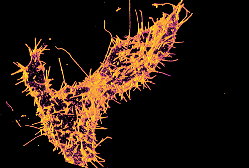 Cultured kidney cell with spike-like structures protruding from it.